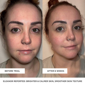 BEAUTYPRO - LED Wand - 5 in 1 Anti-Ageing Device