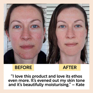 UpCircle Beauty UK - Collagen Boosting Vegan Organic Coffee + Rosehip Face Oil: Refill